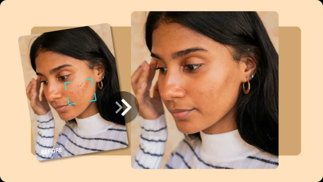 Jak usuwać pryszcze? Poznaj bezpieczne metody i unikaj błędów!