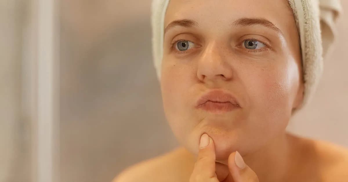 Jak pozbyć się pryszczy podskórnych? Bezpieczne domowe SOS