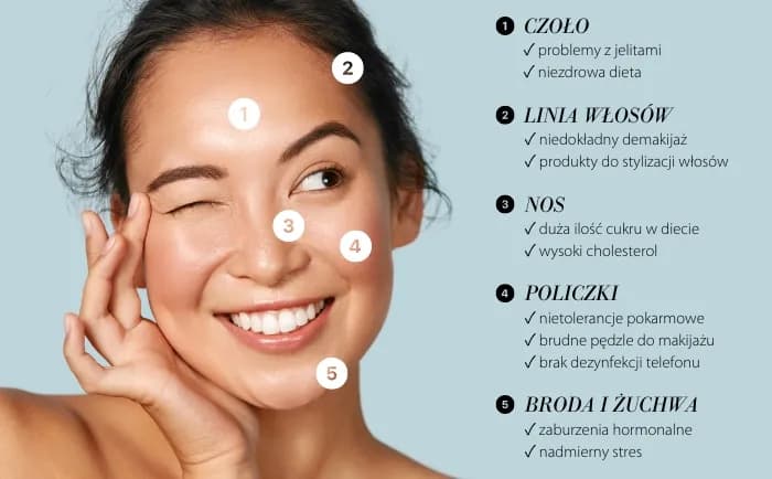 Pryszcze na twarzy: Poznaj skuteczne metody i porady eksperta