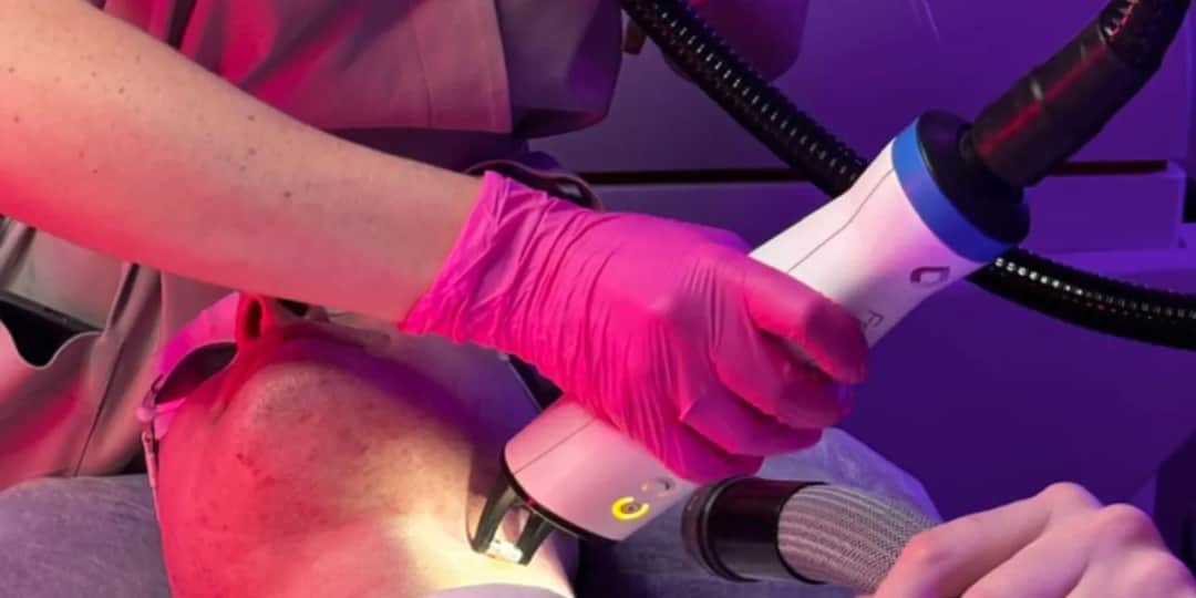 Depilacja laserowa latem? Nowoczesne lasery i bezpieczne zasady