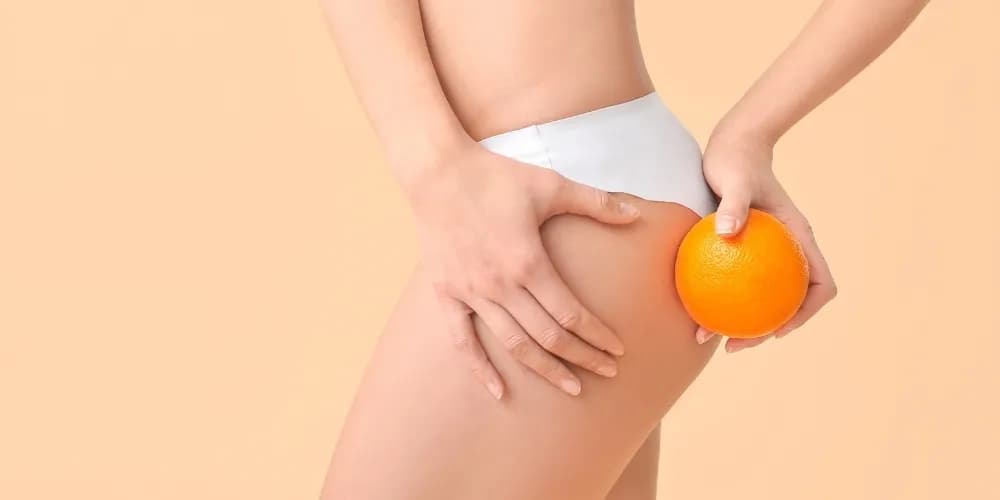 Jak usunąć cellulit? Domowe sposoby i skuteczne zabiegi