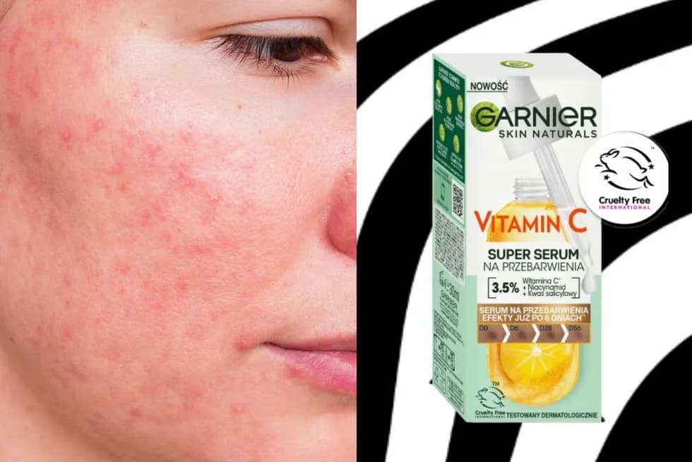 Co daje serum z witaminą C? Rozjaśnij przebarwienia, ujędrnij skórę!