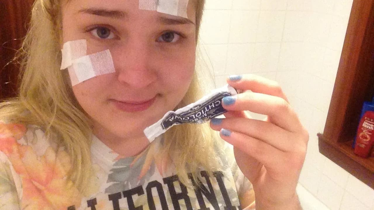 Maść ichtiolowa na pryszczu: Ile trzymać dla efektu i bezpieczeństwa?